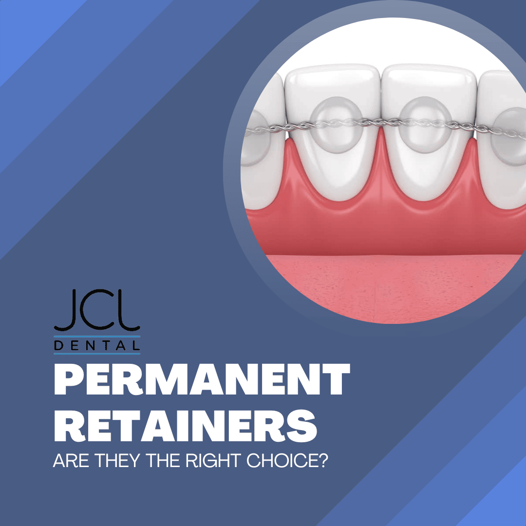 Permanent Retainers In Manhattan | Cosmetic Dentistry Near Midtown